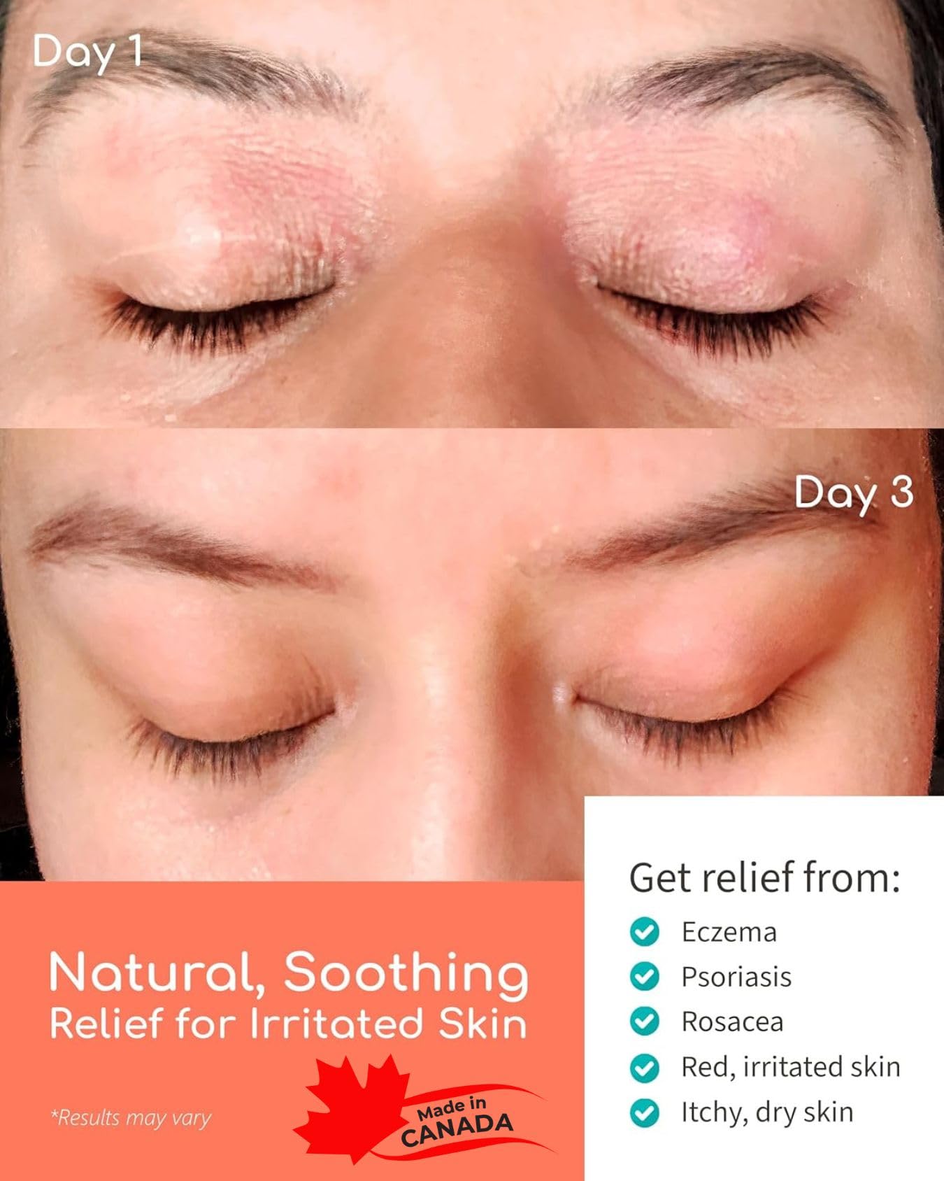 천연 스킨케어로 피부 진정 효과
(Natural skincare soothes skin effectively)