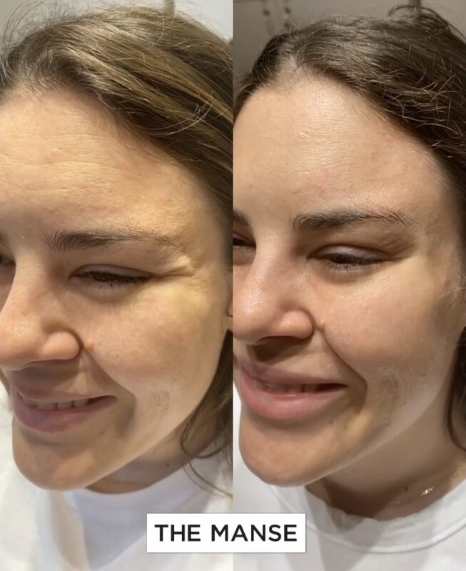 안티에이징 주름개선 피부탄력 UP 효과
(Anti-aging wrinkle reducing and skin tightening UP effect)