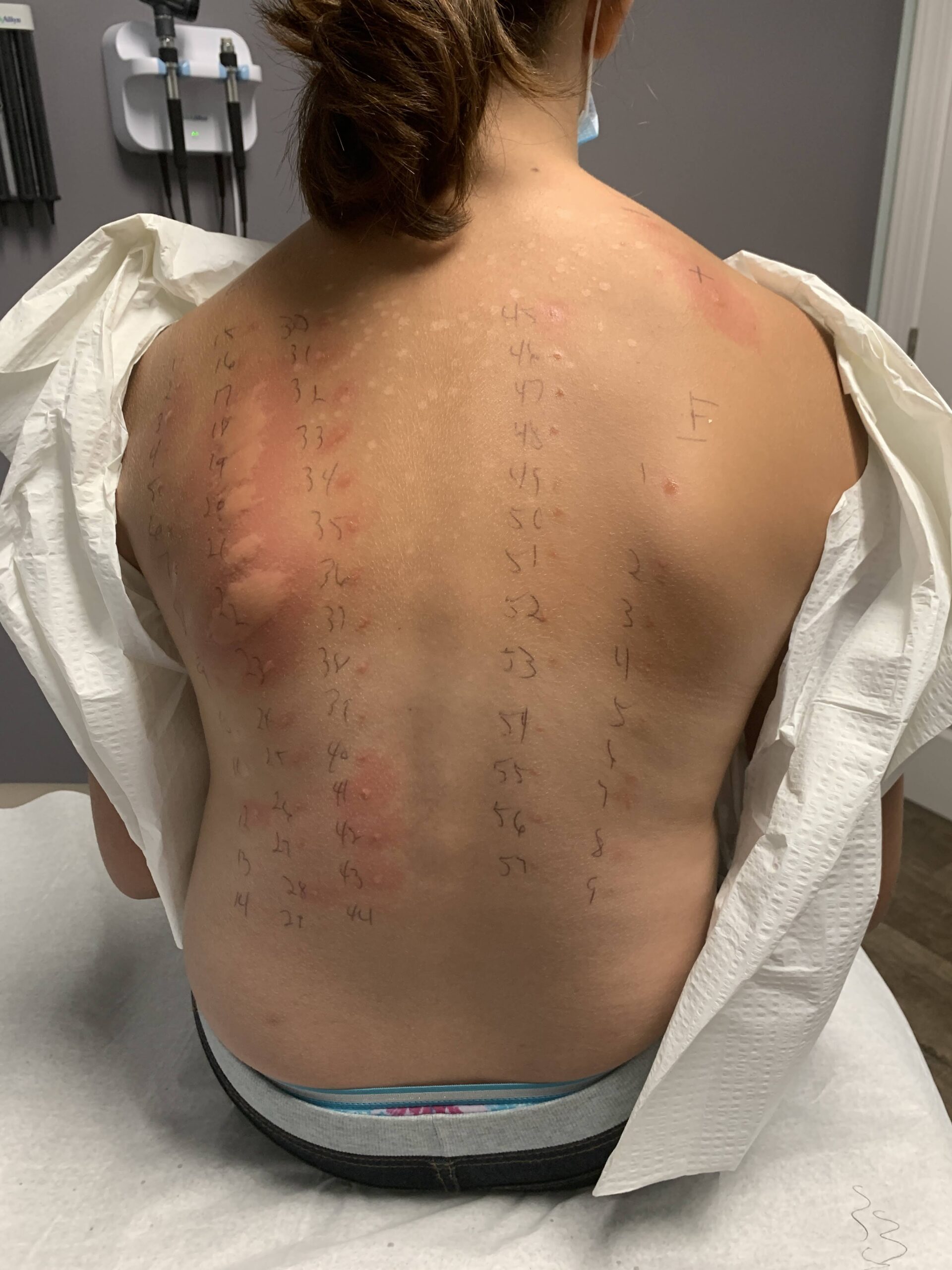 인간을 위한 동물 알레르기 검사
 (Animal allergy test for humans)