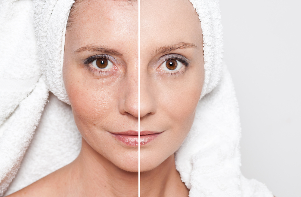 50대 천연 스킨케어로 피부 개선
(50dae cheonyeon seu kinkeeolo pibu gaeseon)
(Natural skincare for skin improvement in 50s)