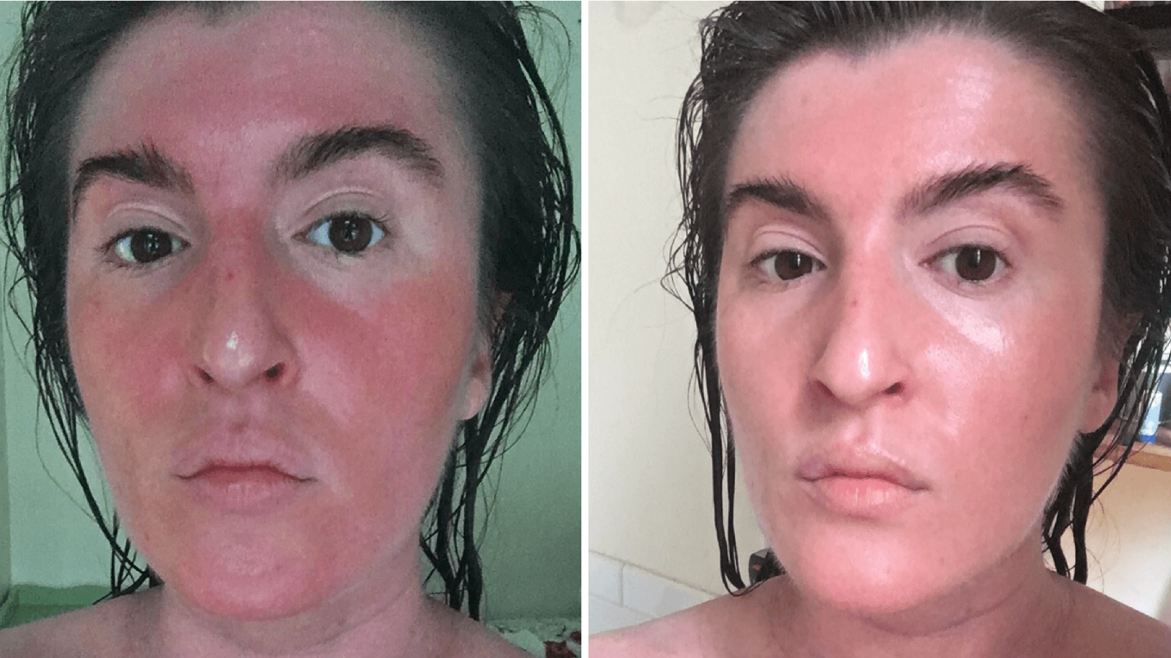 유기농 한국 스킨케어 효과와 추천
(Organic Korean Skincare Effects and Recommendations)